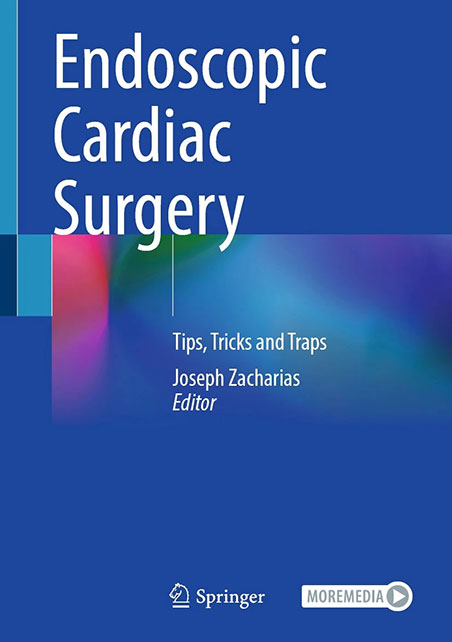 Endoscopic Cardiac Surgery | Tips, Tricks and Traps by Joseph Zacharias