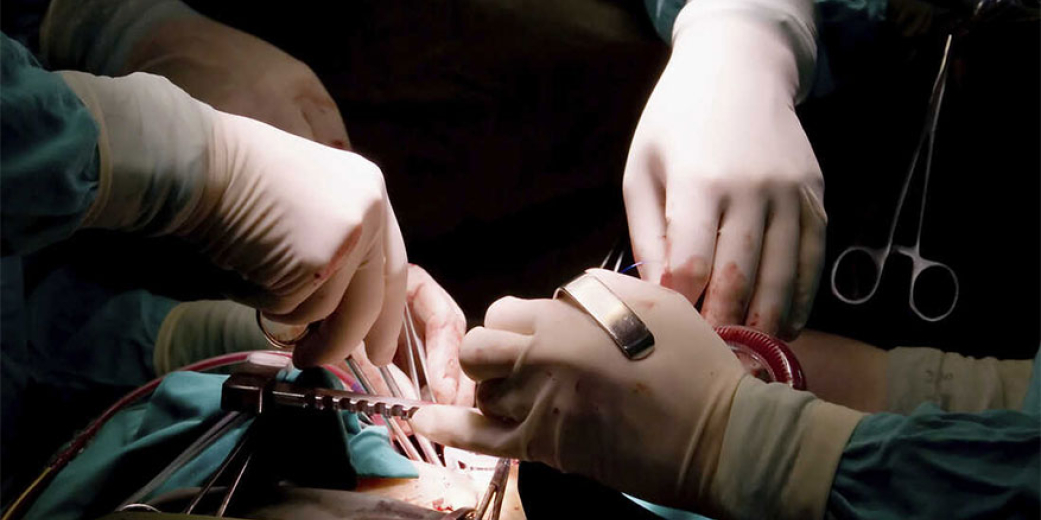 Surgeon specific results are bad for patients, surgeons and institutions