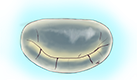 mitraltherapies