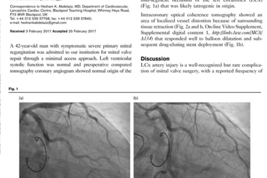 Iatrogenic left circumflex vessel occlusion after minimal access mitral valve repair: the role of optical coherence tomography. 