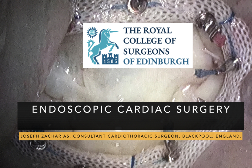 Endoscopic Cardiac Surgery: RCS Edinburgh talk
