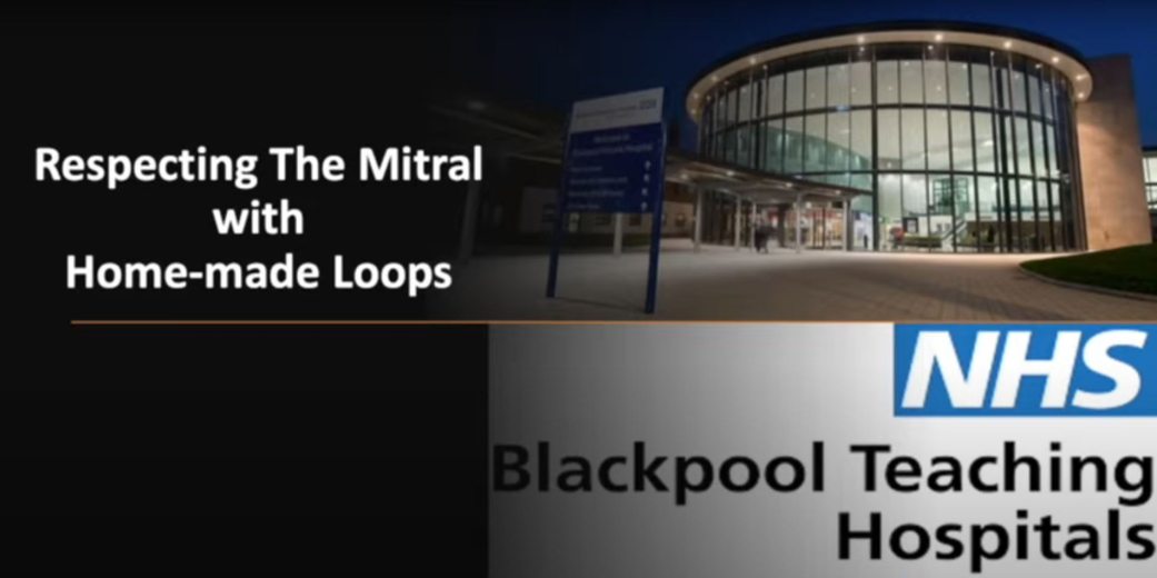 Respecting the Mitral With Homemade Loops