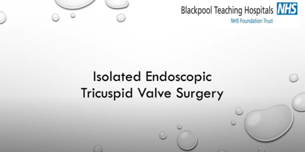 Isolated Endoscopic Tricuspid Valve Surgery