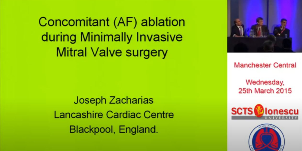 Concomitant AF Ablation During Minimally Invasive Mitral Valve Surgery