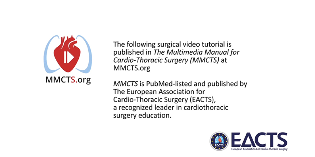 Endoscopic cardiac surgery for redo tricuspid valve repair