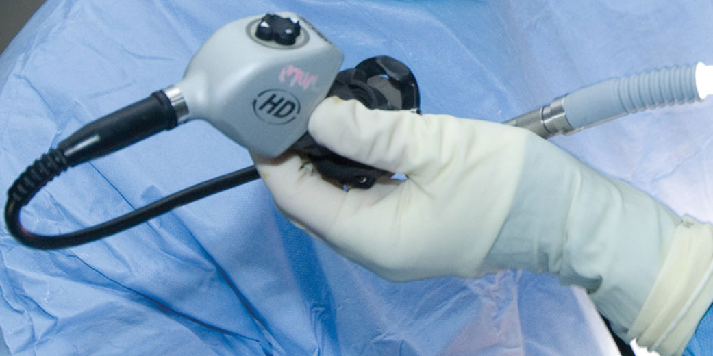 Endoscopic (VATS) surgery for lung cancer
