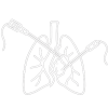 Endoscopic (VATS) surgery of Mediastinal masses
